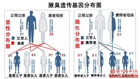 大连女性有狐臭生孩子遗传吗