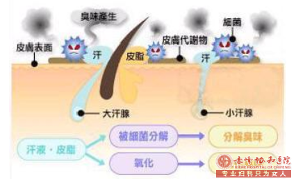 大连红山区常见的致使腋臭的要素有哪些