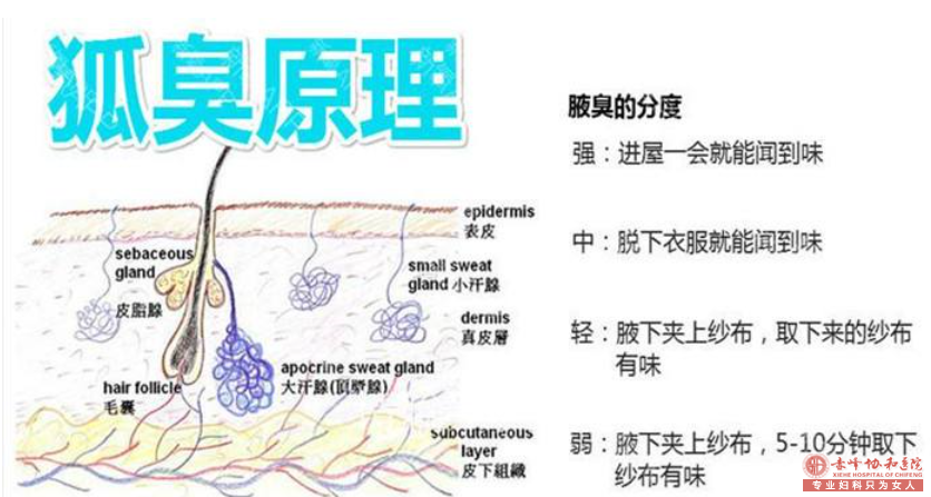 大连巴林右旗夏季如何缓解腋臭病情